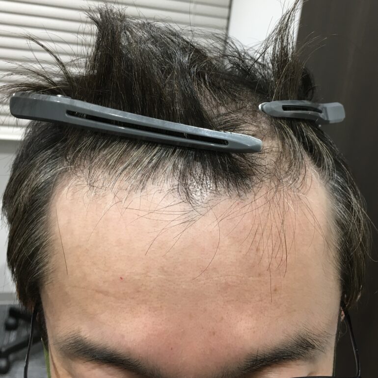 2023.11.18