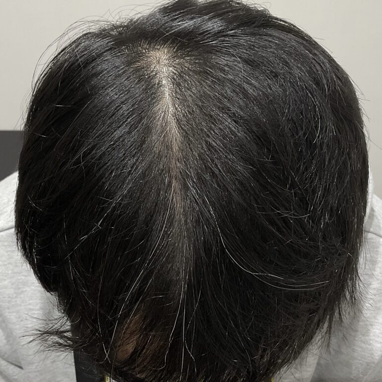2024.11.18