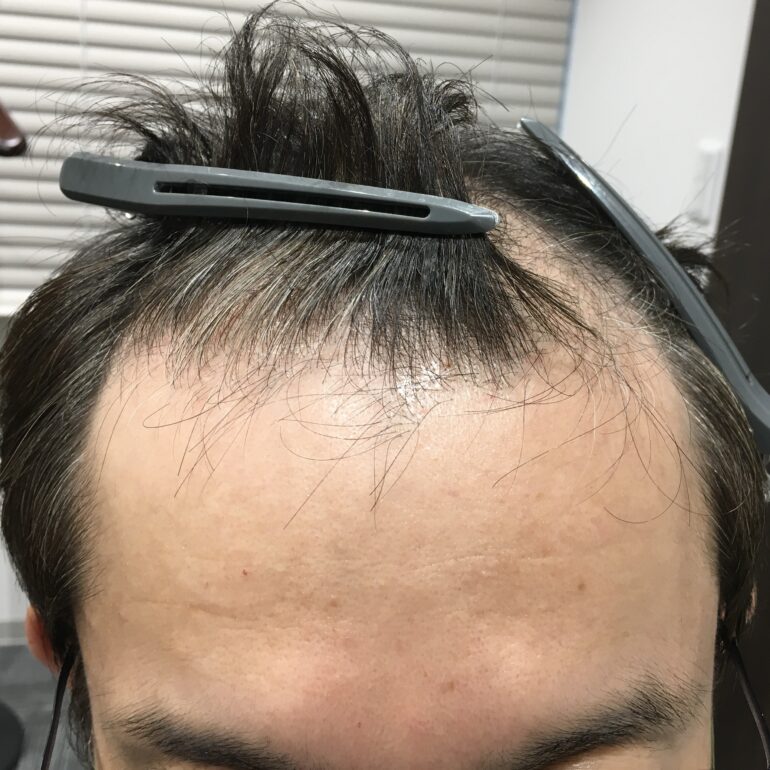 2023.9.21