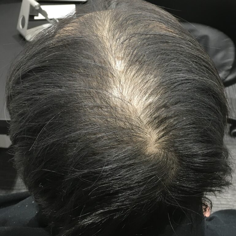 2024.3.18