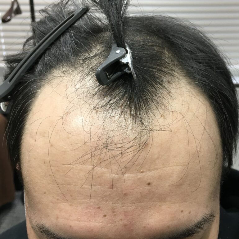 2024.3.18
